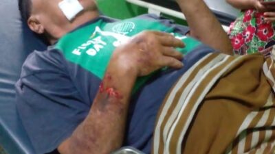 Yuskal mengalami luka ringan akibat jatuh ke sungai pasca robohnya salah satu jembatan Sungai Pinang.