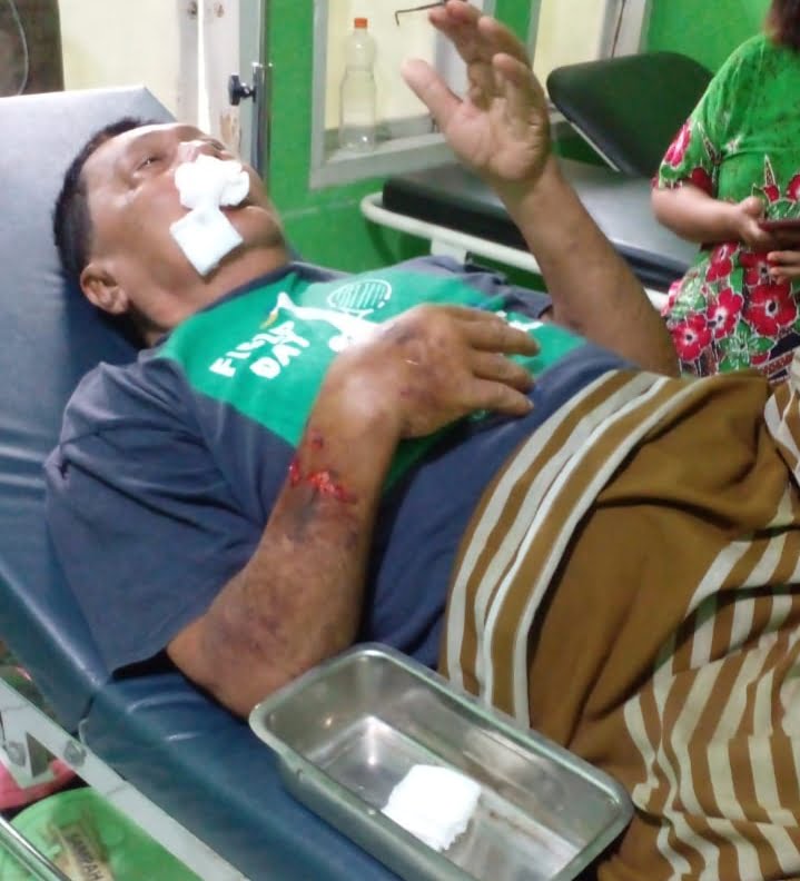 Yuskal mengalami luka ringan akibat jatuh ke sungai pasca robohnya salah satu jembatan Sungai Pinang.